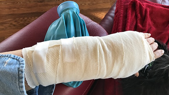 Splint